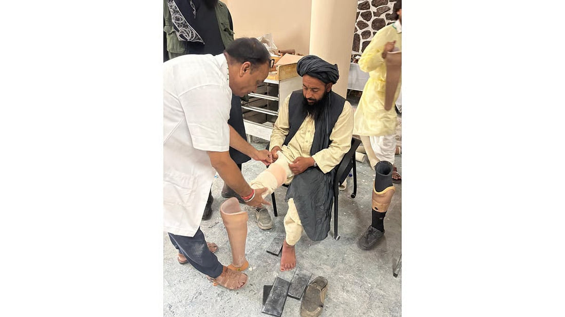 India Conducts Jaipur Foot Camp in Kabul, Provides 75 Prosthetic Limbs