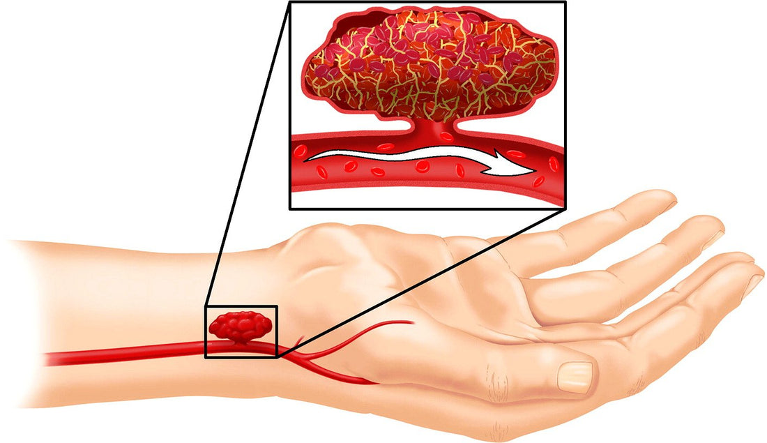 Indian Army Conducts Groundbreaking High-Altitude Artery Surgery in Leh