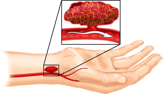 Indian Army Conducts Groundbreaking High-Altitude Artery Surgery in Leh