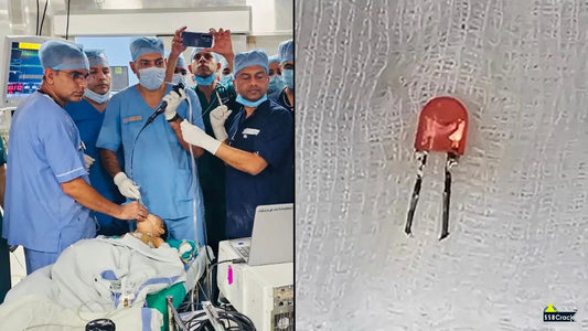 Indian Army Specialists Conduct Life-Saving Bronchoscopy on Infant to Remove LED Bulb from Lung in Pune